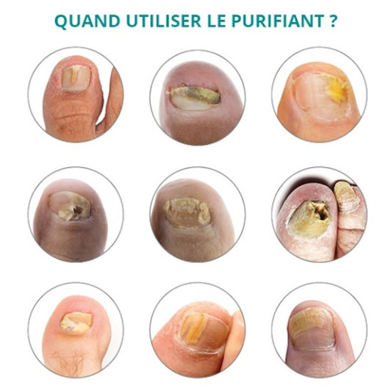PODERM purifiant (8ml)